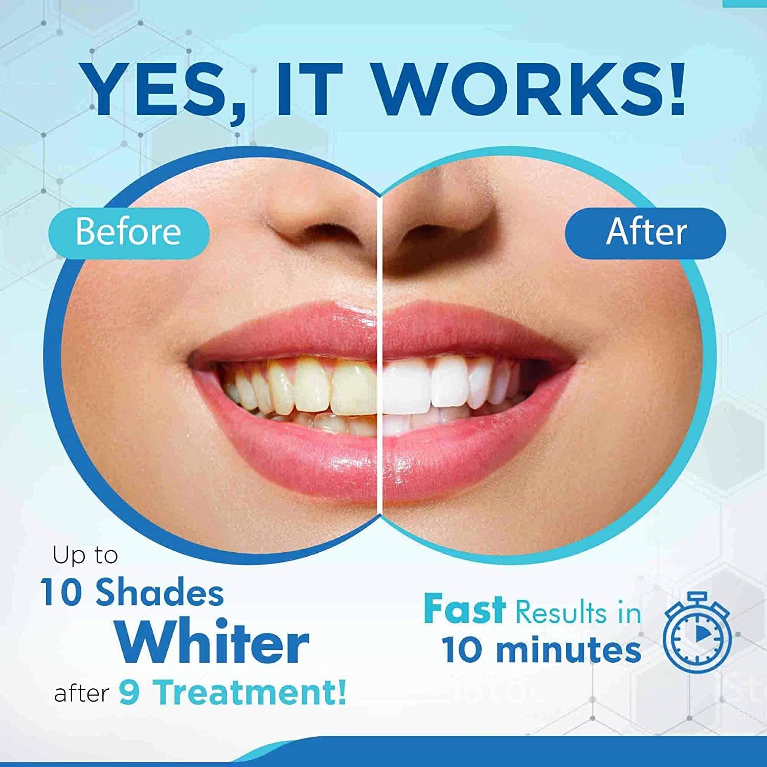 MySmile Teeth Whitening Kit 3ml*3pc Gel Tooth Whitener Bleaching LED Light Tray